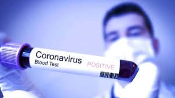Ini Kronologi Dua Warga Indonesia Positif Terinfeksi Virus Corona