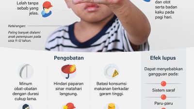 Lupus merupakan penyakit radang yang disebabkan ketika sistem kekebalan tubuh menyerang jaringannya sendiri. Gejala penyakit berjuluk seribu wajah itu harus dicermati dan diwaspadai oleh orang tua jika timbul pada anak-anak.