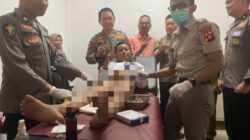 Sambut HUT ke-80 Bhayangkara, Polda Gorontalo Gelar Operasi Katarak hingga Khitanan Gratis
