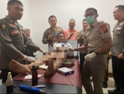Sambut HUT ke-80 Bhayangkara, Polda Gorontalo Gelar Operasi Katarak hingga Khitanan Gratis